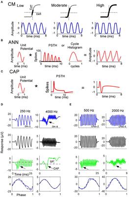 Intraoperative Electrocochleographic Characteristics of Auditory Neuropathy Spectrum Disorder in Cochlear Implant Subjects